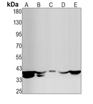 hNRNP C Rabbit Monoclonal Antibody