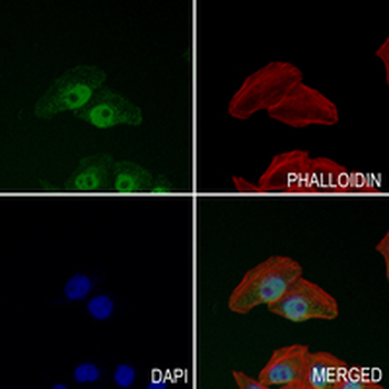 hNRNP C Rabbit Monoclonal Antibody