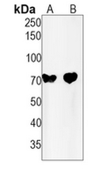 TAU (Phospho-S713/396) Rabbit Monoclonal Antibody