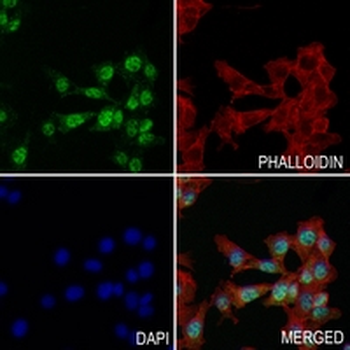 TAU (Phospho-S713/396) Rabbit Monoclonal Antibody