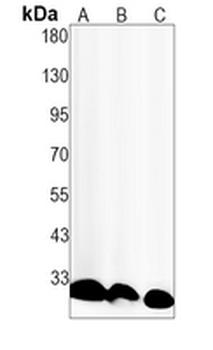 Histone H1 (Phospho-T17) Rabbit Monoclonal Antibody