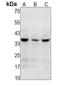 CDK1/2 (Phospho-T14) Rabbit Monoclonal Antibody