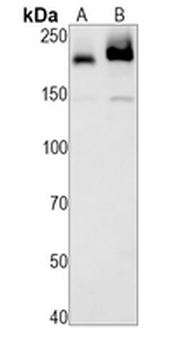 CD45 Rabbit Monoclonal Antibody