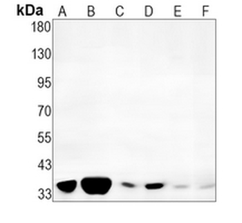 CDK1/2/3 (Phospho-T14) Rabbit Monoclonal Antibody
