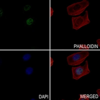 c-Jun Rabbit Monoclonal Antibody