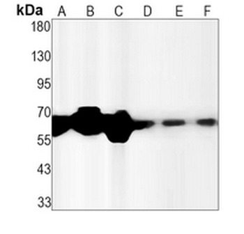 MMP14 Rabbit Monoclonal Antibody