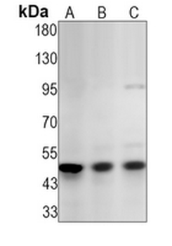 PTEN Rabbit Monoclonal Antibody