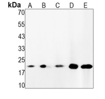 H-Ras Rabbit Monoclonal Antibody