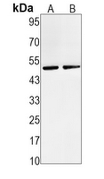MMP3 Rabbit Monoclonal Antibody
