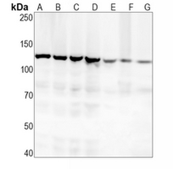 Vinculin Rabbit Monoclonal Antibody