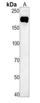 EGFR Rabbit Monoclonal Antibody