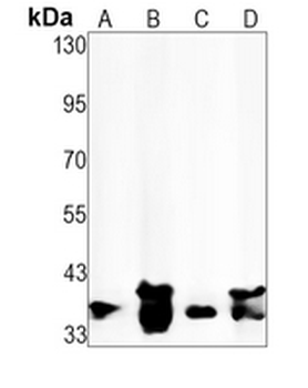 EIF2S1 (Phospho-S51) Rabbit Monoclonal Antibody