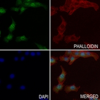 EIF2S1 (Phospho-S51) Rabbit Monoclonal Antibody