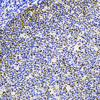 MCM2 (Phospho-S108) Rabbit Monoclonal Antibody