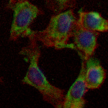 Alpha-1A Adrenergic Receptor Rabbit Monoclonal Antibody