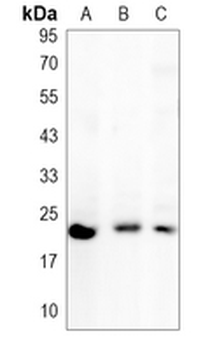 RAC1/2/3 Rabbit Monoclonal Antibody