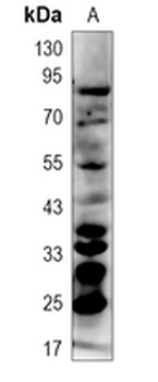 Ubiquitin (Linkage specific-K63) Rabbit Monoclonal Antibody