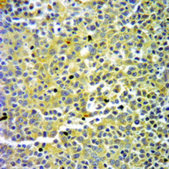 Ubiquitin (Linkage specific-K63) Rabbit Monoclonal Antibody