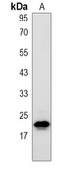 CBFB Rabbit Monoclonal Antibody