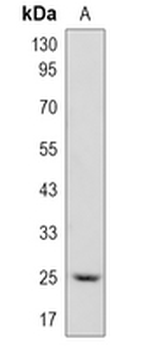 Cathepsin S Rabbit Monoclonal Antibody