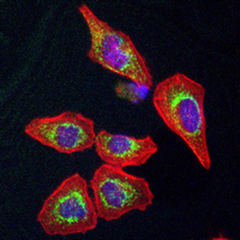 Cathepsin S Rabbit Monoclonal Antibody