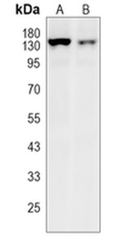 ULK1 (Phospho-S556) Rabbit Monoclonal Antibody