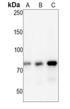 TAK1 (Phospho-S439) Rabbit Monoclonal Antibody