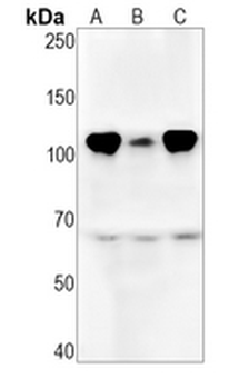 RB1 (Phospho-S780) Rabbit Monoclonal Antibody