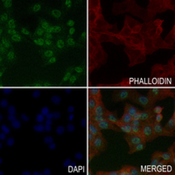 RB1 (Phospho-S780) Rabbit Monoclonal Antibody