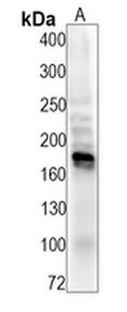 HER2 (Phospho-Y1221+Y1222) Rabbit Monoclonal Antibody