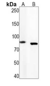 TBK1 (Phospho-S172) Rabbit Monoclonal Antibody