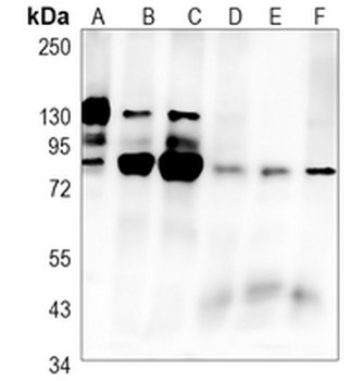 PKC alpha (Phospho-T638) Rabbit Monoclonal Antibody