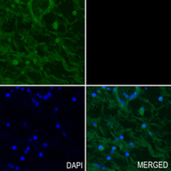 PKC alpha (Phospho-T638) Rabbit Monoclonal Antibody