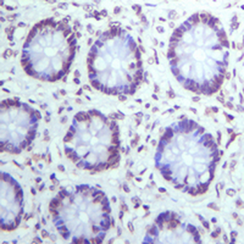 STAT3 (Phospho-Y705) Rabbit Monoclonal Antibody