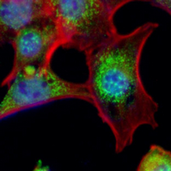 STAT3 (Phospho-Y705) Rabbit Monoclonal Antibody