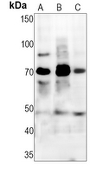 c-RAF (Phospho-S43) Rabbit Monoclonal Antibody