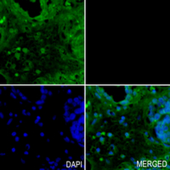 c-RAF (Phospho-S43) Rabbit Monoclonal Antibody