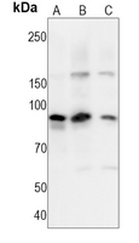 B-RAF (Phospho-T401) Rabbit Monoclonal Antibody