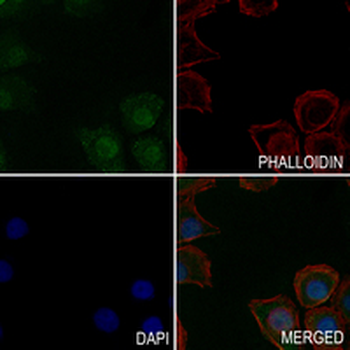 B-RAF (Phospho-T401) Rabbit Monoclonal Antibody