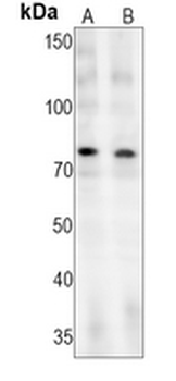 c-RAF (Phospho-S621) Rabbit Monoclonal Antibody