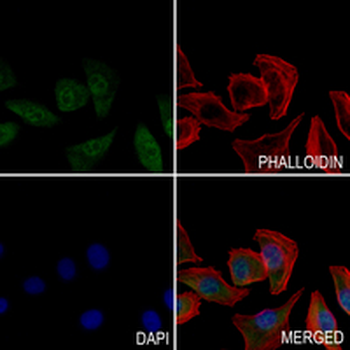 c-RAF (Phospho-S621) Rabbit Monoclonal Antibody