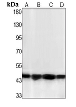 MKK1 (Phospho-T292) Rabbit Monoclonal Antibody