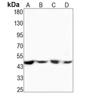 MKK1 (Phospho-S298) Rabbit Monoclonal Antibody