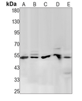 PTEN (Phospho-S380) Rabbit Monoclonal Antibody