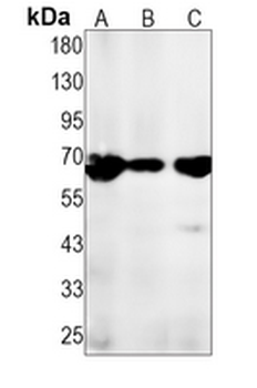 PKC zeta (Phospho-T560) Rabbit Monoclonal Antibody