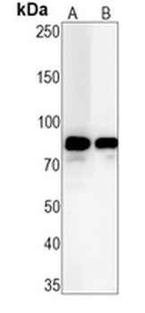 HSL (Phospho-S853) Rabbit Monoclonal Antibody