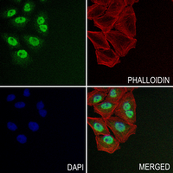 MSK1 (Phospho-S376) Rabbit Monoclonal Antibody