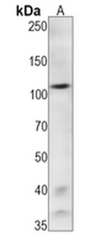 IRE1 (Phospho-S724) Rabbit Monoclonal Antibody