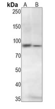 STAT5 (Phospho-Y694) Rabbit Monoclonal Antibody