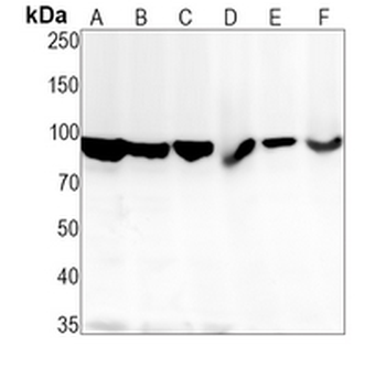 FOXO3 (Phospho-S253) Rabbit Monoclonal Antibody